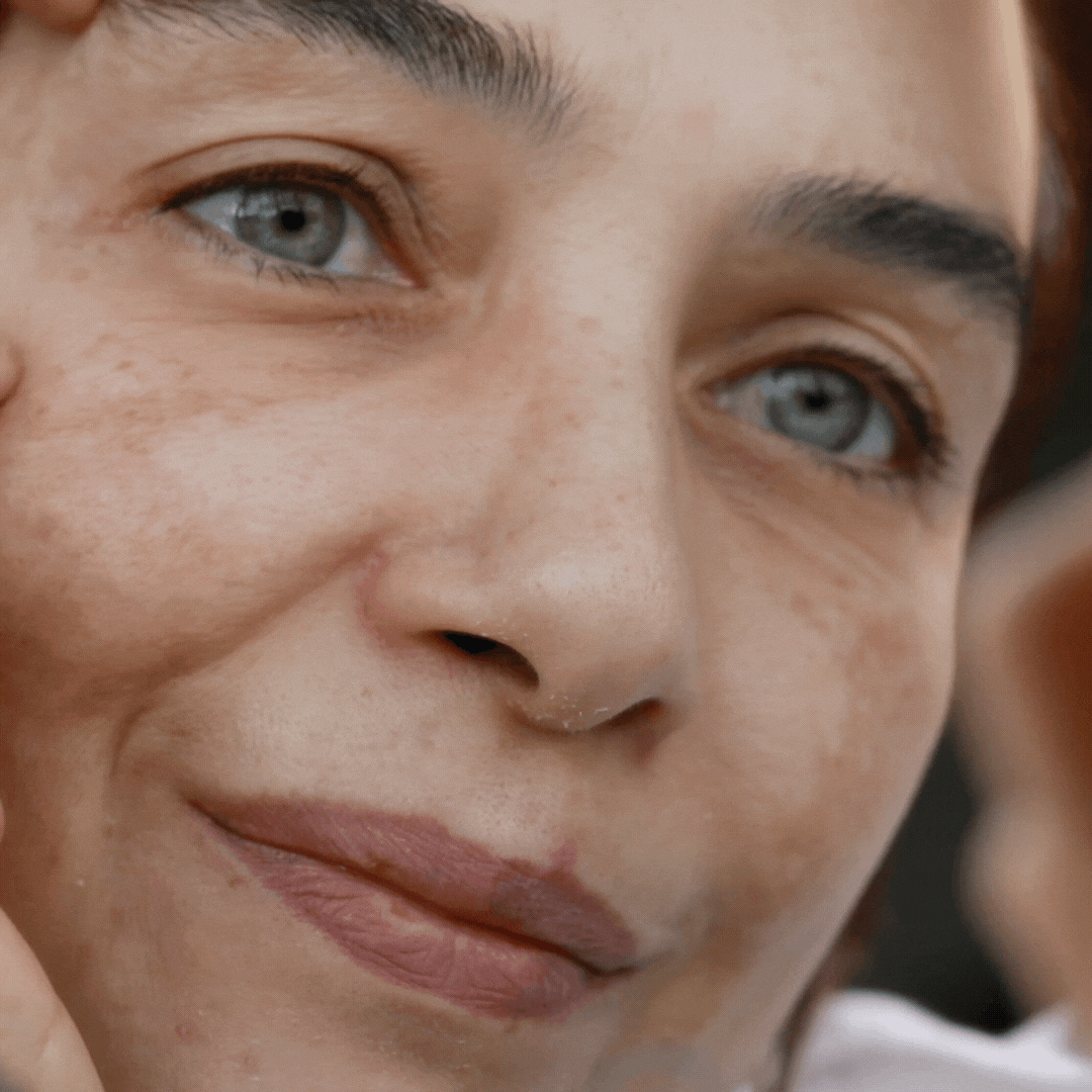 Fine Lines & Wrinkles